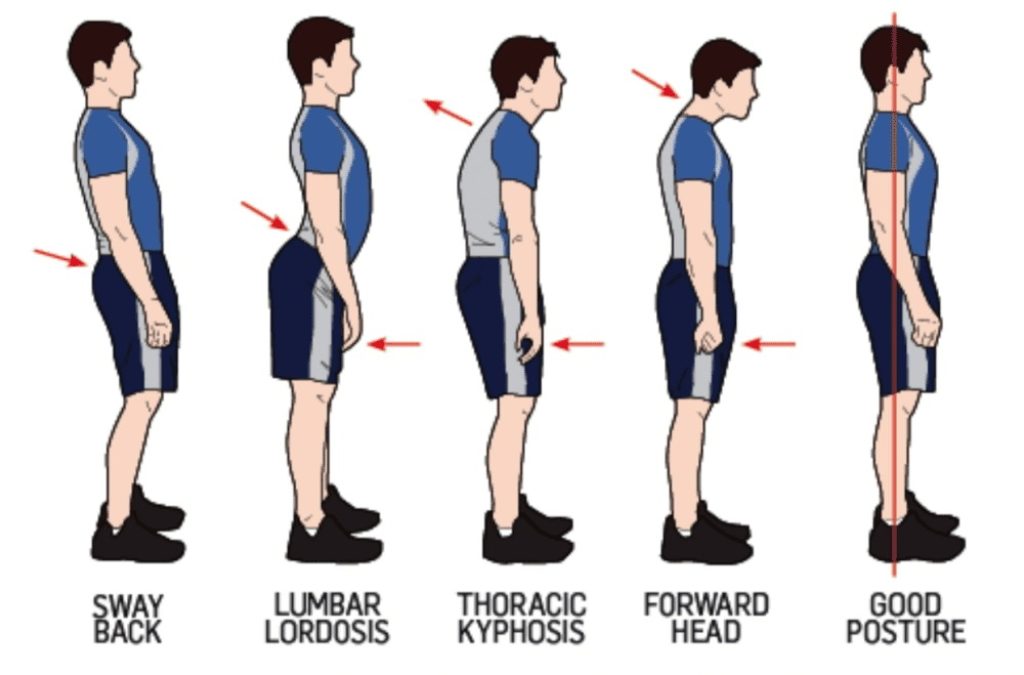 Benefits of better posture