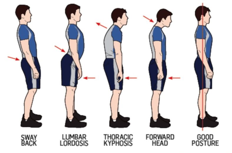 Why Is Sitting up Straight Uncomfortable? 2 Key Causes